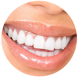 Adequado para cada paciente, rápidos e com controle da sensibilidade. Dentes brancos e um sorriso iluminado.