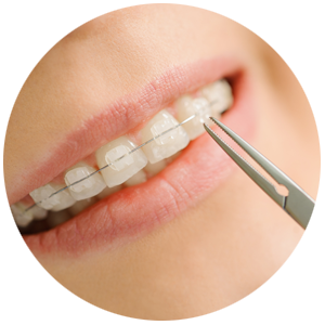 Ortodontia tratamento Centro Odontológico Higienópolis
